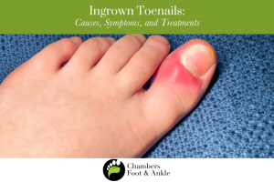 Ingrown Toenails: Causes, Symptoms, and Treatments Chambers Foot & Ankle
